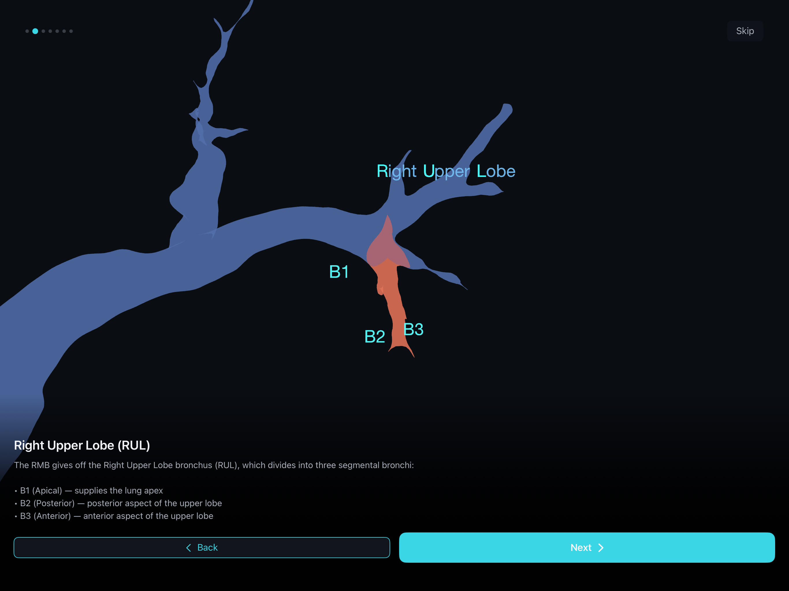 BronchoQuest - メイン画面。3D気管支モデルと気管支鏡のビュー